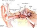 Tinnitus Choices: Musical ear syndrome Tinnitus