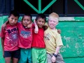 Albino Children : Innocence Versus Ignorance on bloglovin