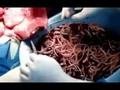 #youtube OMG!! Bodybuilder's Colon Contains 10 lbs of MEAT WORMS!!