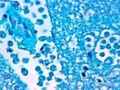 Brain-eating amoeba found in 2 water systems