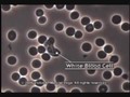 Acidic Blood vs Alkaline Blood