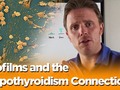 What are Biofilms? - Biofilms And The Hypothyroidism Connection