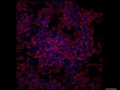 PLoS Pathogens : Adhesive Fiber Stratification in Uropathogenic Escherichia coli Biofilms Unveil...