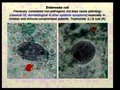 Parasites and Cancer - Dr. Omar Amin