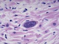 Targeting Common Parasite Could Help Treat Certain Mental Disorders - Psychiatry Advisor