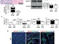 High Phosphate Induces and Klotho Attenuates Kidney Epithelial Senescence and Fibrosis