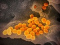 Low white blood cell counts linked to severe COVID-19 cases getmixapp
