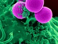 Physicians for Safe Technology | Immune and Endocrine System getmixapp