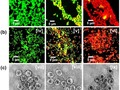 Antimicrobial silver: An unprecedented anion effect getmixapp