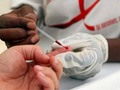 Prueban en España un tratamiento experimental contra el VIH