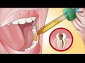 I added a video to a YouTube playlist Échate una Gota de esto en las Caries y Mira lo que Pasa media Hora