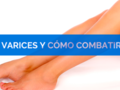 '"Vivir en salud"- ¿Curar las varices en casa en un mes? ¡Ahora es posible!' in Salud España via Georgeta_q
