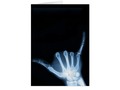 Blue x-ray of the 'hang loose' Shaka hand sign card is blank inside and ready for your text. X-Ray (Hang Loose)Card