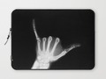Hang Loose X-Ray Laptop Sleeve by #Gravityx9 at #Society6 ~~  Chooser 13" or 15" sleeve to protect your laptop!…