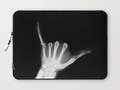 Hang Loose X-Ray Laptop Sleeve by #Gravityx9 at #Society6 ~~ Chooser 13" or 15" sleeve to protect your laptop!…