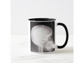 Foot in Mouth X-Ray Mug *  "Been There, Done That"? Who hasn't? We've all had the 'foot in mouth' disease at one t…