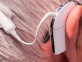 🐢 Nuevo implante auditivo mejora la audición con estimulación opto acústica...