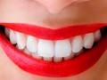 馃搶 C贸mo presumir de una dentadura blanca y bonita...