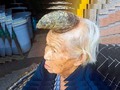 📌 ¿Mujer unicornio? China de 87 años impresiona con un gran cuerno en la frente...