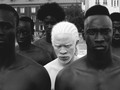 📺 ¿Existe el racismo inverso? ¿Se discrimina a gente blanca?...