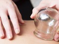 ¿Qué es el cupping? Así es el tratamiento de moda entre deportistas y famosos #KatyNews
