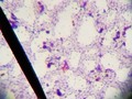 Not a great pic, but this was the result of a Gram stain. Most cells appear as cozy, only outlined by CV. Why?…