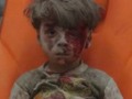 Syria conflict: Image of injured boy in Aleppo draws outrage: Syrian activists have released haunting picture...
