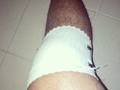 Ahora a cuidarme... :( :( :( #Knee #Pain