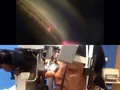@unidadoftplazamadrid - Trabeculoplastia argón laser. #glaucoma #trabeculoplastia #ojo #Pío #Oftalmologia #Regrann