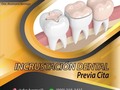 Devuelve esa sonrisa que tanto soñabas en @dra.bermej0 🦷😁 Desliza   Recuerda que tu dentadura es la carta de presentación!!  Visitanos 👌🏻 agenda tu cita al tlf. 8092183415 📍estamos ubicados en la Avenida Núñez de Cáceres, Plaza mi Placita #23  Te esperamos .......    #sorisa #resinas #odontologia #blanqueamientodental #dientessanos #limpiezadental #dientes #salud #caries #consultorio #venezolanosenrd #venezolanosrd #venezolanosenelmundo #RD
