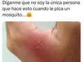 100% Comprobado👏🏻 Cuenta la leyenda que si te pica un mosquito y te haces una cruz, ya no te vuelve a picar ahí nunca más... ¿Qué opinas? By: @iperita_