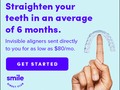 FREE After-Rebate Impression Kits at SmileDirectClub!