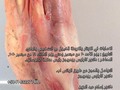 التواصل والحجز عن طريق الواتس اب. دكتور كارلوس رودريجز  +584143227748 دكتور إسلام عبد العزيز. +2 01069975129.