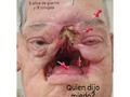 Aquí voy de nuevo a la guerra Con 6 tumores malignos al quirófano  Nuevo reto para @wmplastic  Le ha tocado muy duro a mi lado Solo un ángel enviado por Dios hace lo que el ha hecho con mi cara y esta enfermedad maligna  Acabo de salir de de una Radioterapia que casi me cuesta la vida Para perder mi tiempo esfuerzo y dolor  Como si fuera poco lo vivido hasta este momento  No estoy solo, junto a mi lado un batallón de ángeles me acompañan En esta difícil guerra a muerte contra el hombre de la guadaña Estaré de nuevo en el Hospital Clínica Caracas  Quien sabe cuantos días hospitalizado Agradezco a Dios Al Presidente @nicolasmaduro a la @vicevenezuela @delcyrodriguezv Al ministro de la cultura @ernestovillegaspoljak a @petroleosdevenezuela  A mi papá, Fundación Petrolera Nacional Alí Rodríguez Araque quien desde el cielo me ayuda en este proceso. A mi esposa @dfyli a toda mi familia a @caballosaludsara mi hija y a @ermibu y @olgamerce mis hermanas quienes no me aflojan. Todo va a salir bien un cuando estoy preparado para la guerra, la adrenalina no deja de fluir por mis venas  Gracias a todos los que han puesto de nuevo un grano de arena en este proyecto de vida que no es más que la mía  Ya llegué a la clínica y empieza este nuevo Calvario Cargando mi propia cruz a cuestas Nadie sino yo se cuanto pesa La cargo en el lomo mientras me azotan Voy aguantando todo mientas pedazos de mi cara acaban en la basura  Solo Dios sabe hasta donde es este camino Me lleva de la mano Mientas yo camino.  #CaballosaludCreeEnDios amén 🙌