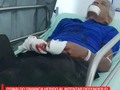 #LOCAL | Por defender el Parque de las Américas de Magangué, Oswaldo Simanca Galvis de 65 años fue apuñalado, el lunes en la madrugada cuando intento evitar el hurto de cable de iluminación del parque.  El hombre se encuentra hospitalizado en el hospital la Divina misericordia tras ser intervenido por lesiones considerables en sus manos.  #MAGANGUE #HEROE #PARQUE #HOSPITAL #CHEVERISIMA
