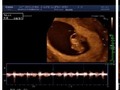 Los latidos de tu corazón ❤ son mi música 🙏🙏😍🎹🥁🎧🎤🎶🎵 gracias mi princesa @j_algariin por hacerme padre.  . . . . . . . . . . #family #familia #baby #mylove #