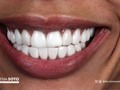 The moment you want has arrived, you want a perfect smile like it is in resin or ceramic lenses. Come to Cali (Colombia) and take advantage of our smile design promotion.  It includes: - Transportation - Accommodation. - Treatment "Smile Design"  Live the experience leave your smile in the hands of experts  Bookings: 🛩 🇺🇸🇨🇴 Contáctanos @dra.lorenasotob WhatsApp: +57 314 547 3898 . . . #diseñodesonrisa #cosmeticdentistry #smile #smiledesingn #nuevodiseño #esteticadental #porceinervenveners #steticdentistry #calicolombia @carolinas_ch #diseñodesonrisa #manizales #tumaco #pereira #ny #miami #miamiflorida #newyork #chile #republicadominicana #santodomingo #ecuador #argentina #mexico #georgia #atlanta #smile #smiledesingn #expertaensonrisas