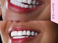 Luce una sonrisa brillante - Deja tu sonrisa en manos de expertos Smile design ðŸ’Ž Dra Lorena Soto  ðŸ›© ðŸ‡ºðŸ‡¸ðŸ‡¨ðŸ‡´  ContÃ¡ct: @dra.lorenasotob  WhatsApp: +57 314 547 3898 . . #diseÃ±odesonrisa #cosmeticdentistry #smile #smiledesingn #nuevodiseÃ±o #esteticadental #porceinervenveners #steticdentistry #calicolombia #diseÃ±odesonrisa #manizales #tumaco #boston #nuevajersey #republicadominicana #santodomingo #ny #miami #miamiflorida #newyork #chicago #losangeles #argentina #mexico #smile #smiledesingn #expertaensonrisas #georgia #atlanta #texas #colombia