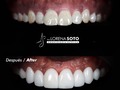 🦷😊   Smile design 💎 Dra. Lorena Soto  @firstclasstaxandconsulting @coach_jaymar   🛩 🇺🇸🇨🇴  Contáct: @dra.lorenasotob  WhatsApp: +57 314 547 3898 . . #diseñodesonrisa #cosmeticdentistry #smile #smiledesingn #nuevodiseño #esteticadental #porceinervenveners #steticdentistry #calicolombia #diseñodesonrisa #manizales #tumaco #boston #nuevajersey #republicadominicana #santodomingo #ny #miami #miamiflorida #newyork #chicago #losangeles #argentina #mexico #georgia #atlanta #texas #michigan