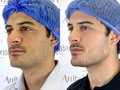 Cuenta la leyenda que si comentas aquí⬇️ serás el próximo “Don massimo Torricelli” (360)😱🔥   ⭐️Etiquéta a tu Amigo/ Novio/ esposo.  👩🏻‍⚕️Procedimientos: ✅Rinomodelación ✅Masculizacion facial ✅Filler ojeras. ✅Hidratación de labios. ✅Filler mentón.  #thedoctorofthestars #masculinizacionfacial #LaDoctoraDeLasEstrellas #sevalesoñar