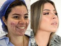 ¡Descubre el secreto para tener un rostro Hollywood! ✨🤩 Obtener resultados como estos requieren disciplina, compromiso y un cambio en tu estilo de vida.  Comenta muchos 💖 si este cambio te pareció ¡ Wow! Y quieres tener uno así👇🏻🤩👀. Si quieres constatar sus cambios puedes seguirla 👉ella es la talentosa y estrella @spathdj