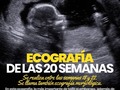 Es el #momento óptimo para hacer un #estudio detallado del feto: porque ya es lo suficientemente grande, porque tiene #desarrollados prácticamente todos sus órganos y sistemas y porque existe una buena cantidad de #líquido amniótico, imprescindible para poder realizar una #valoración ecográfica adecuada. #liquidoamniotico #bebé #embarazo #mujer embarazada #ginecologia #obstetricia #cmisanjuan #clinicasanjuan #Maracaibo #Zulia #Venezuela #dr.cesarbrachomachado #cenbra #ZULIA  #medicina #altoriesgoobstetrico. #familia #embarazo
