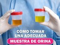 El examen de orina es una de las pruebas más comunes, debido a la simpleza de su muestra.   Sin embargo, su análisis puede indicarnos el estado de nuestros riñones y tracto urinario. También es una prueba muy utilizada en deportes, debido a que la orina es capaz de mostrarnos la absorción de sustancias psicotrópicas o prohibidas, así como la presencia de determinadas hormonas en el aparato reproductor.