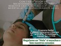 Esta es una forma de Limpieza Facial que no sólo retira las impurezas (comedones o puntos negros)  si no que también permite liberarte de las células muertas que impiden la renovación celular, produciendo un excelente efecto Antiaging o de Rejuvenecimiento. Si quieres renovación celular y limpieza de tu piel, puedes contactarnos para mayor información  0251-252.33.23 / 252.54.03  Lcda Faysuly Santeliz de Zubillaga. #limpieza  #facial #antiaging #rejuvenecimiento #rejuvenecimientofacial #limpiezafacial  #antienvejecimiento  #microdermoabrasion #piel #estética #salud #esperanza #vida #Barquisimeto #FSanteliz #Esposa #DrZubillaga #Radio #Dinámica 92.9FM
