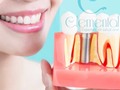 Te hace falta uno o más dientes? Comunícate con nosotros y pregunta por el descuento especial en implantes dentales que tendremos durante el mes de febrero 2022. No te pierdas la oportunidad de recuperar tu sonrisa.  📲 310 397 4163