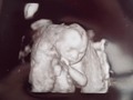 Para la princesa de mamá y papá💖👨‍👩‍👧 Gracias por llegar a nuestras vida, te planeamos, te buscamos y Dios escucho nuestras oraciones para que crecieras en mi vientre. No tengo palabras que describan cuento te amamos en realidad, siento que dos palabras no pueden describir lo que sentimos por ti.  Papi y mami siempre te desearon princesa. Le pedimos a Dios que nunca te falte nada, ni el amor, ni los valores, ni muchos menos nosotros para apoyarte siempre. Fuiste nuestra luz y nuestra unión para toda la vida y lucharemos siempre para hacerte feliz y cumplas el propósito que Dios tiene para ti en este plano terrenal.  Gracias por llegar, Gracias por elegirnos y sobre todo gracias por darnos tanta alegría. Te amamos hija💖
