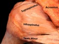 De ver un libro a ver un cadaver o ver una operación la diferencia es de aquí a la #china Podemos aprender de mil maneras pero hay formas únicas e inolvidables #shoulder #pitcher #baseball #beisbol .  @chicagosportsdoc - Rotator cuff anatomy - A tear into one of these tendons is a common cause of pain and disability among adults. Each year, almost 2 million people in the United States visit their doctors because of a rotator cuff problem.