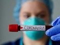 Gobierno reportó 289 casos y 5 muertes por coronavirus