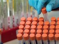 Más de 49 millones de casos de Covid-19 en el mundo