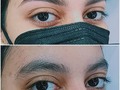 Epilación con hilo